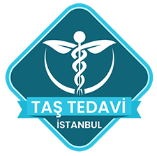 Taş Tedavi